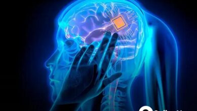 Implante cerebral dá voz aos pensamentos